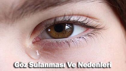 göz sulanması